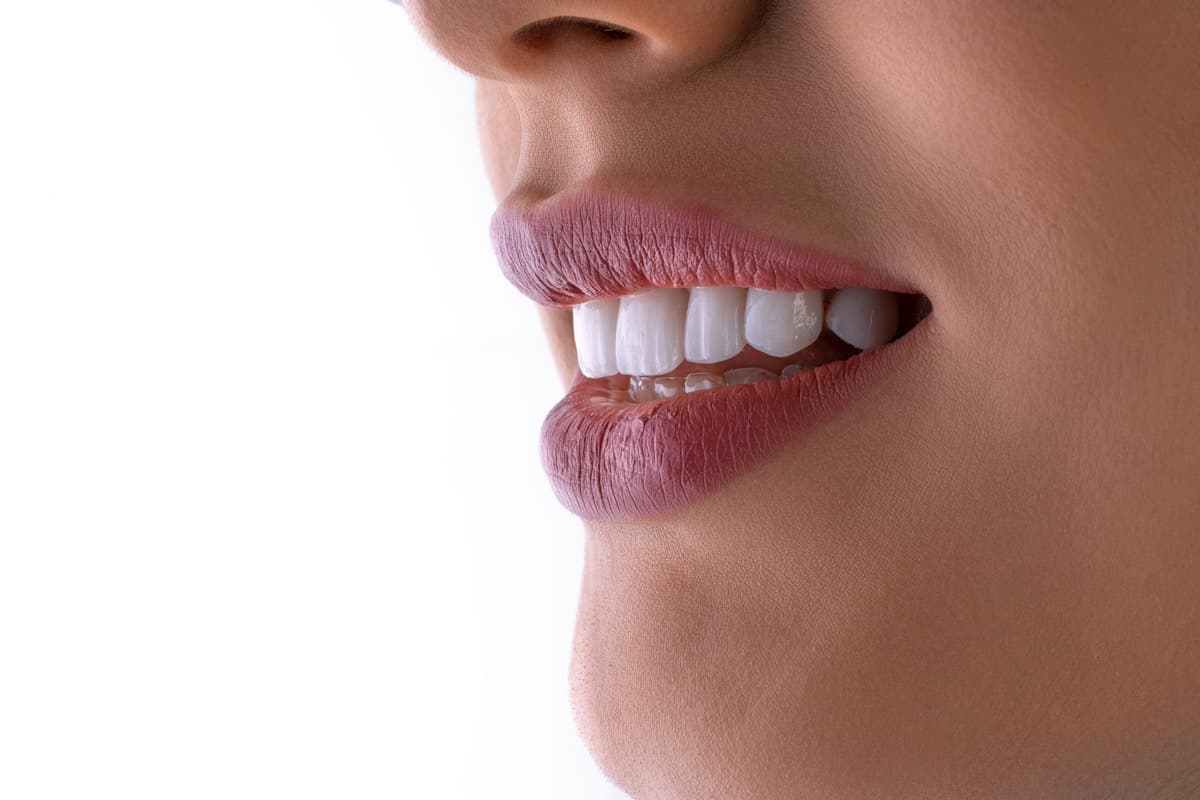 Close-up of a woman's smile showing white teeth
